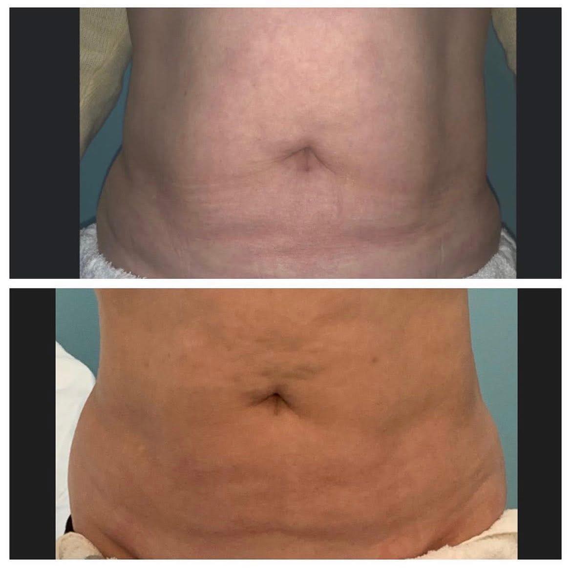 for Arctic Cryotherapy Bayonne in Bayonne, NJ